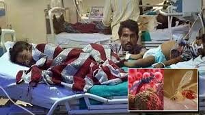 Chandipura Virus :6 Children Die of Suspected in Gujarat,What is the Disease, and What are Its Symptoms?